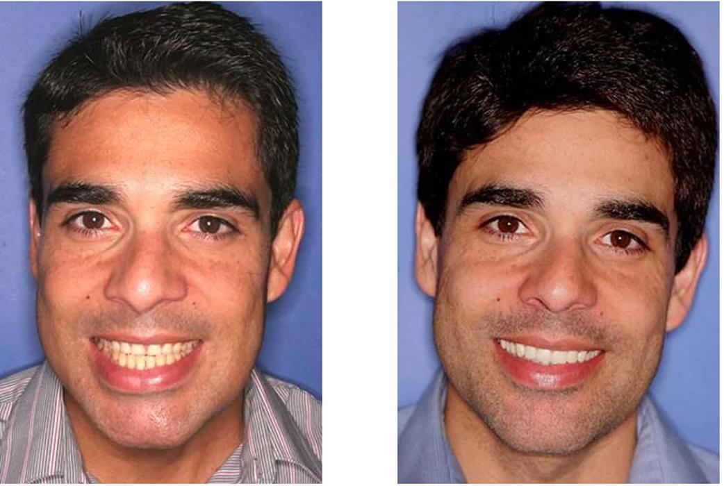 Neal C. Johnson DMD - The Billings Dentist