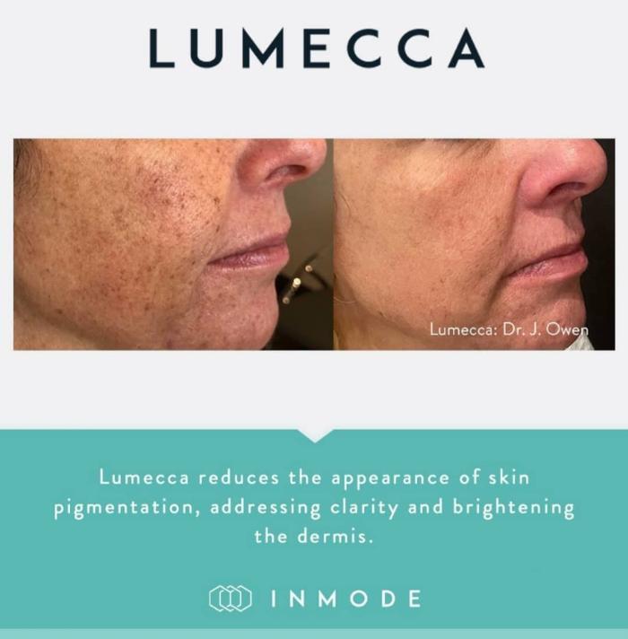 West End Medical Aesthetics