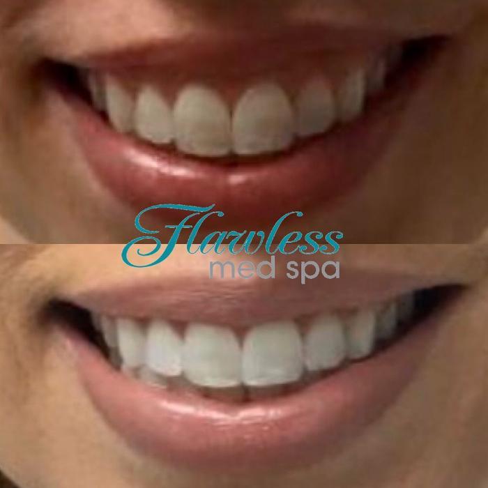 Flawless Med Spa
