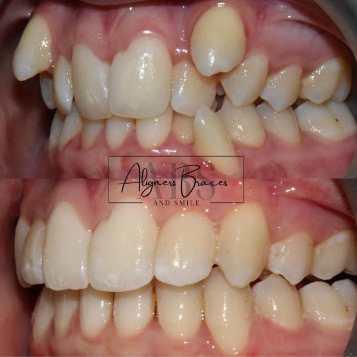 mydentist, Bristol Orthodontics, Kingswood, Bristol