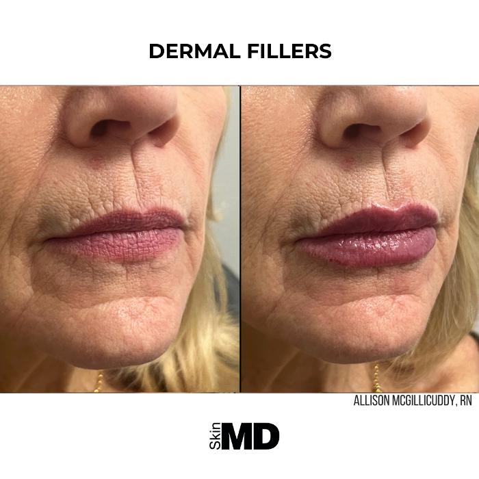 SkinMD Dedham