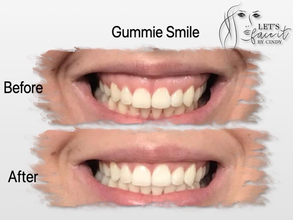 Let's face it by Cindy