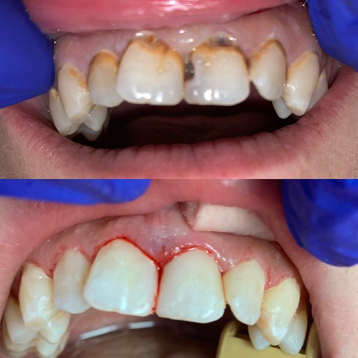 Risas Dental and Braces - Chandler