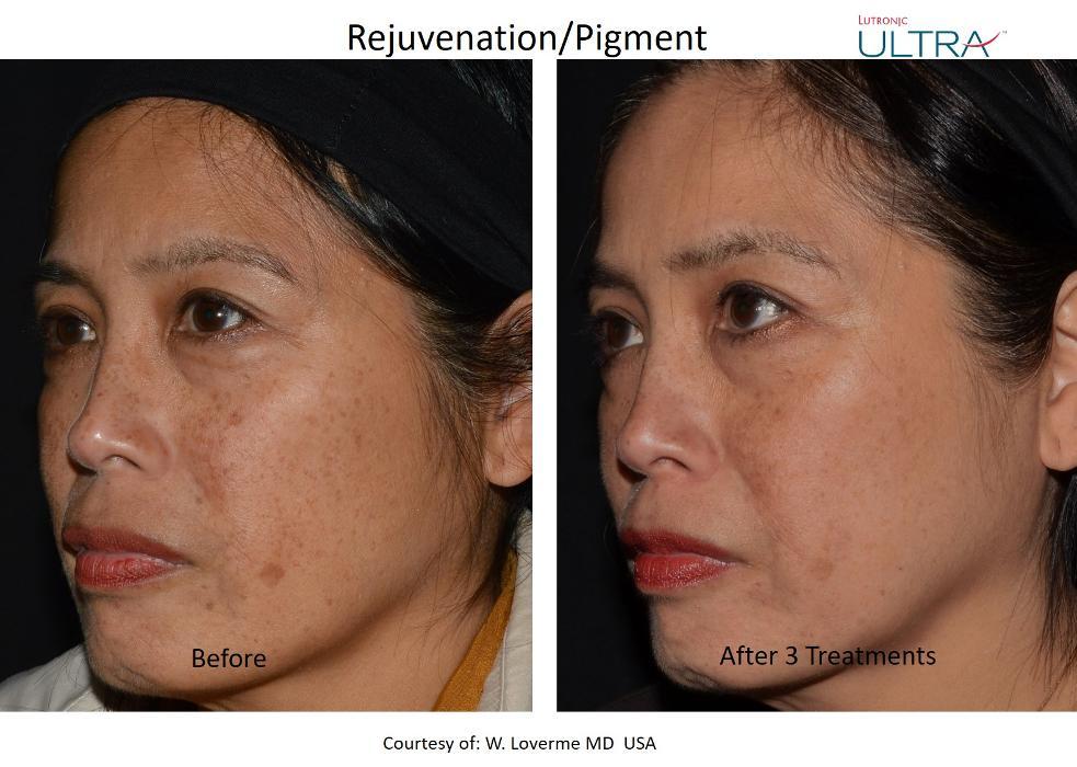 Komoka Skin x Aesthetics