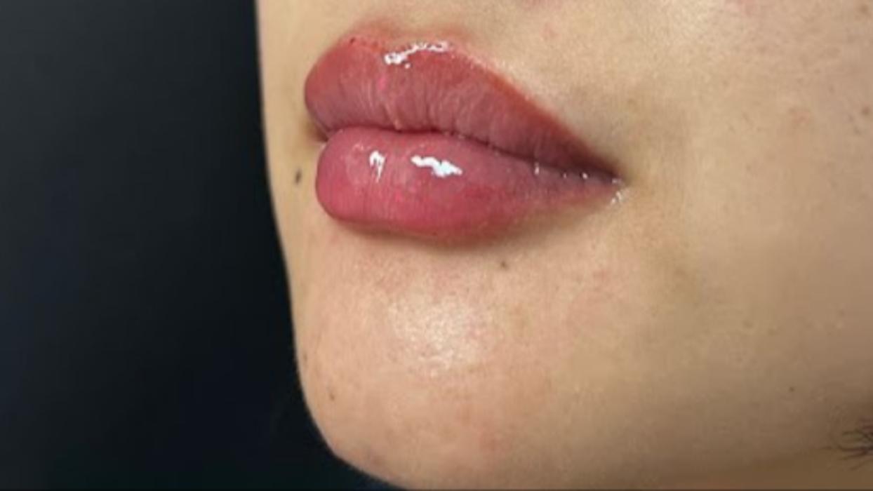 Zen Luxe Medspa & IV Lounge