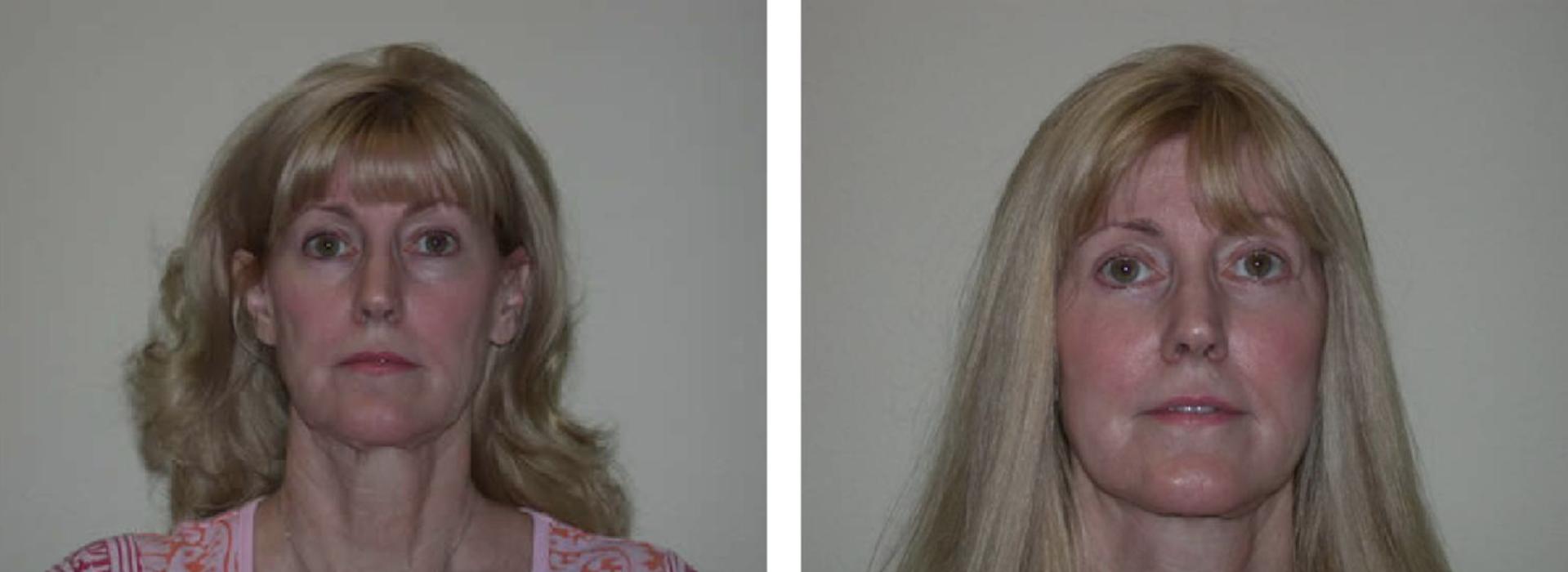 Newport Plastic and Reconstructive Surgery Associates: Dr. Hisham M. Seify