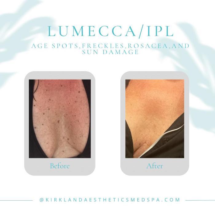 Kirkland Aesthetics Med Spa