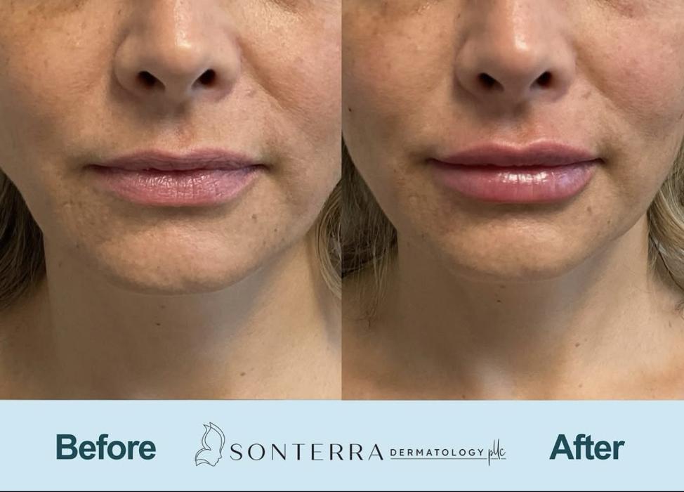 Sonterra Dermatology