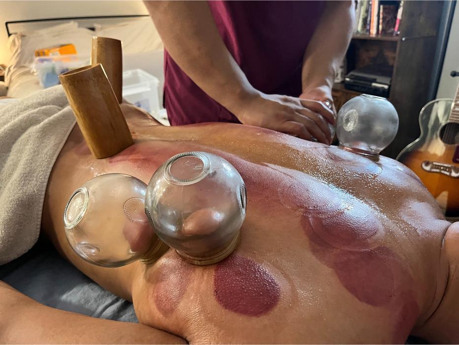 S&Y Mobile Acupuncture