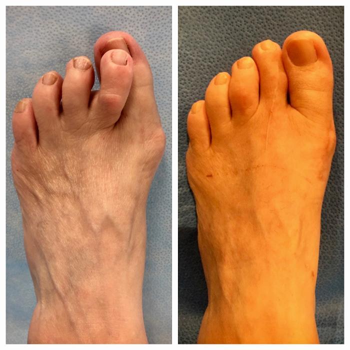 26 Foot and Ankle of Watkinsville