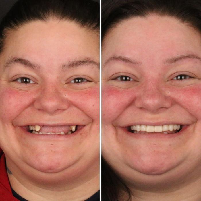 Britely Dentures + Implants Studio