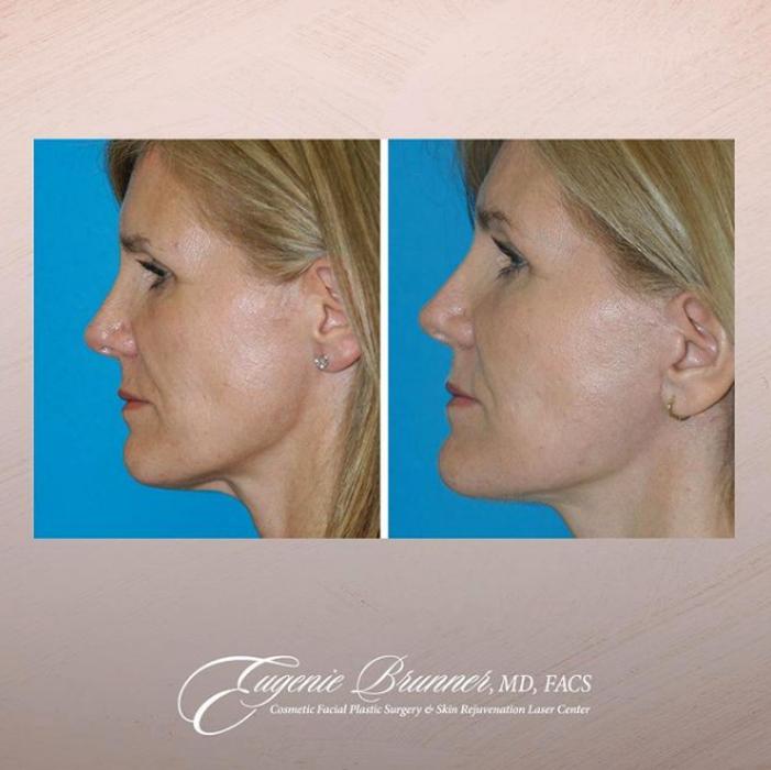 Eugenie Brunner, MD, FACS