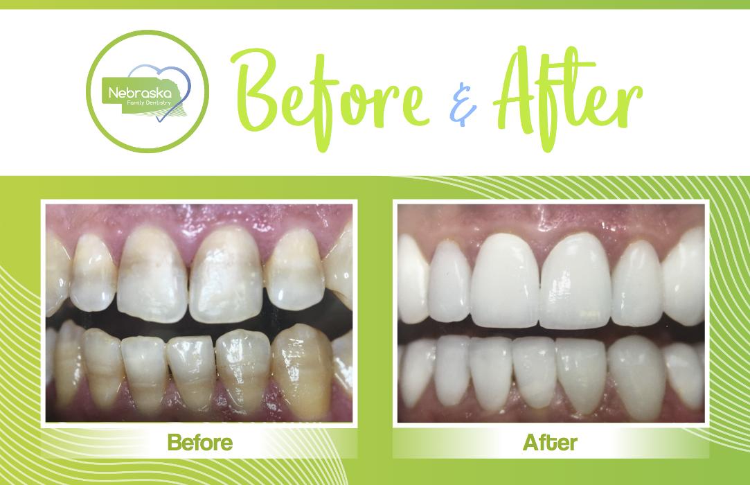 Lincoln Family Dentistry