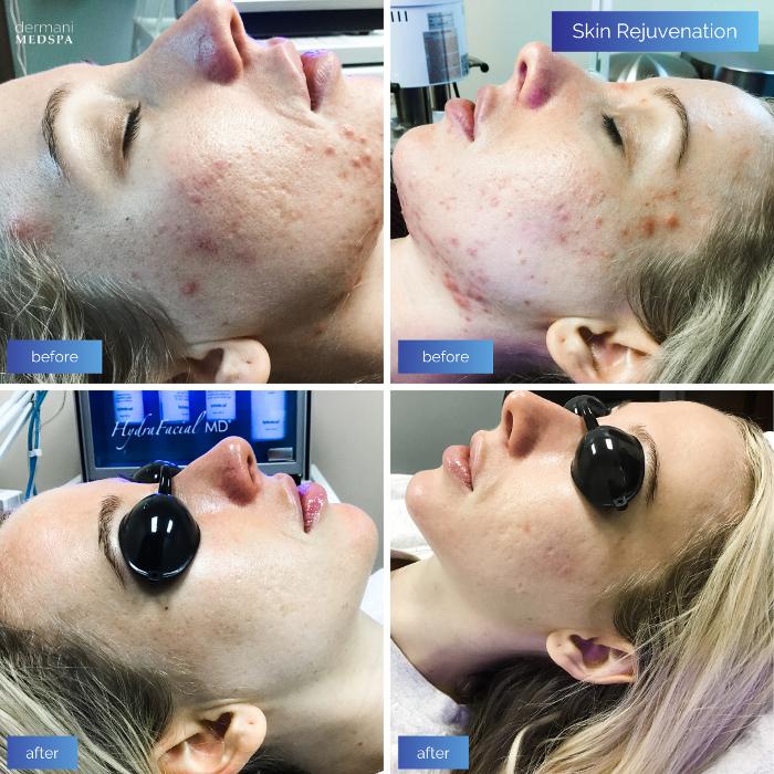 dermani MEDSPA Alpharetta