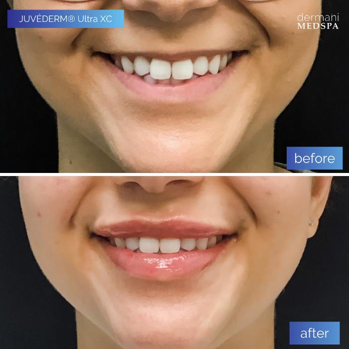 dermani MEDSPA Sandy Springs