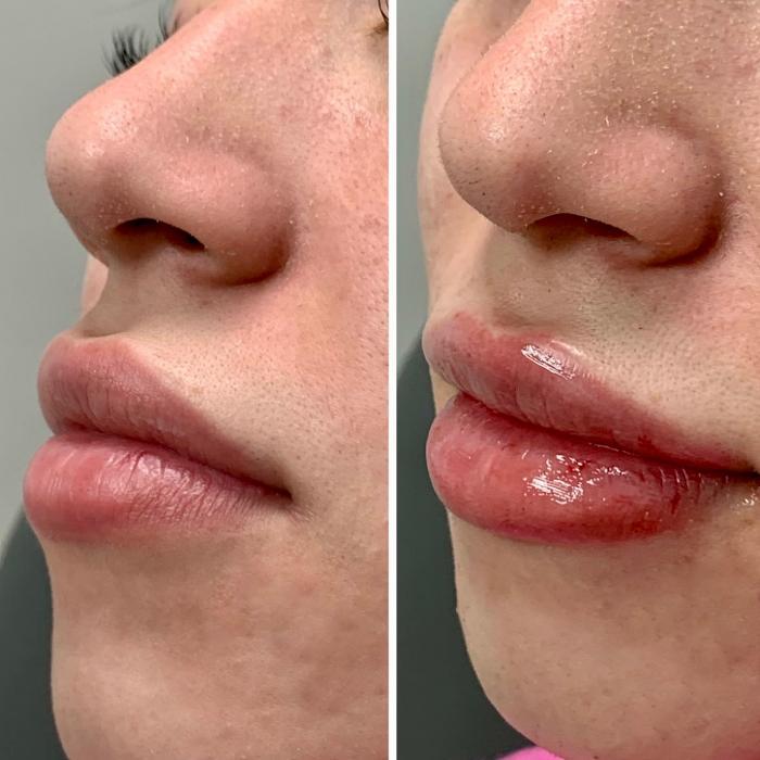 dermani MEDSPA North Buckhead Chastain