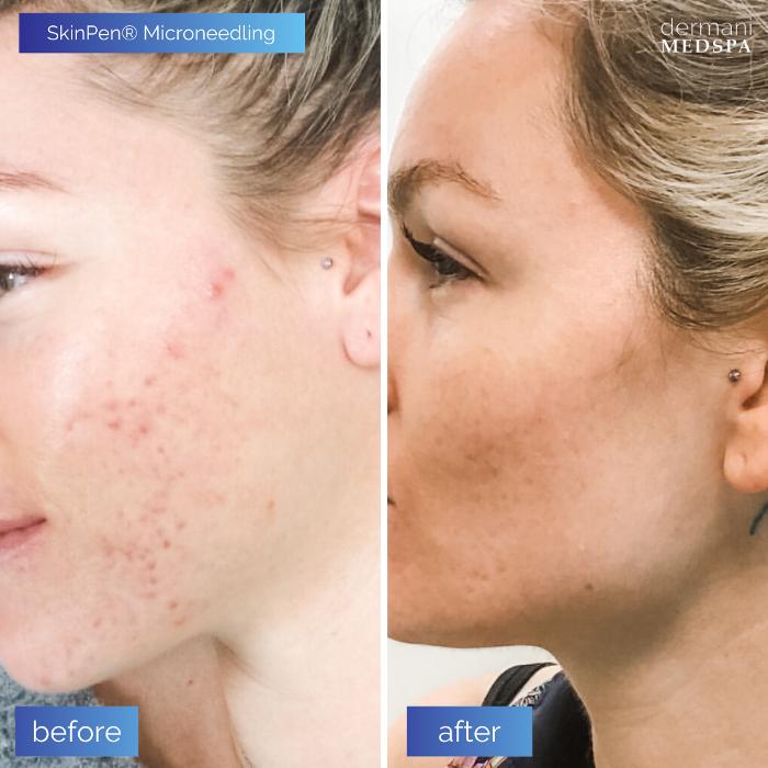 dermani MEDSPA Johns Creek