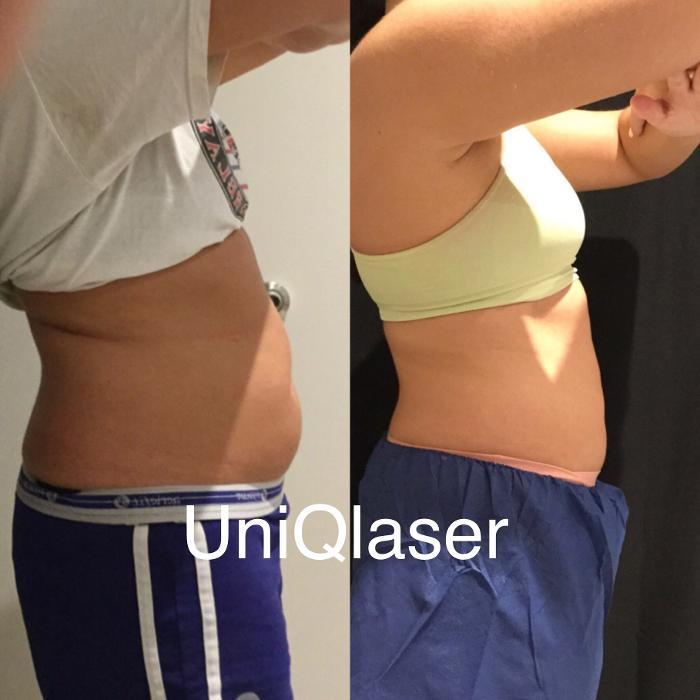 UniQ Laser Center Watertown